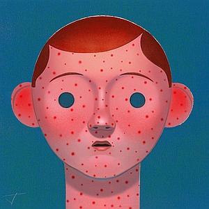Jon Krause - Child, Child Care, Childhood, Disease, Health, Healthcare, Illness, Sickness, Vaccine